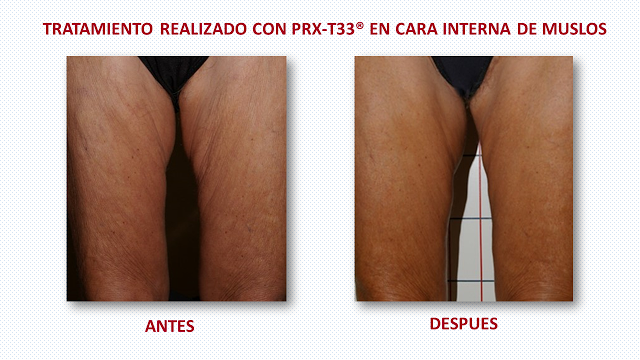 PRX-T33 en la revista Woman PRX-T33 en la revista Woman