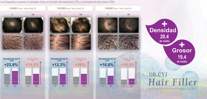 Hair Filler Dr. CyJ.