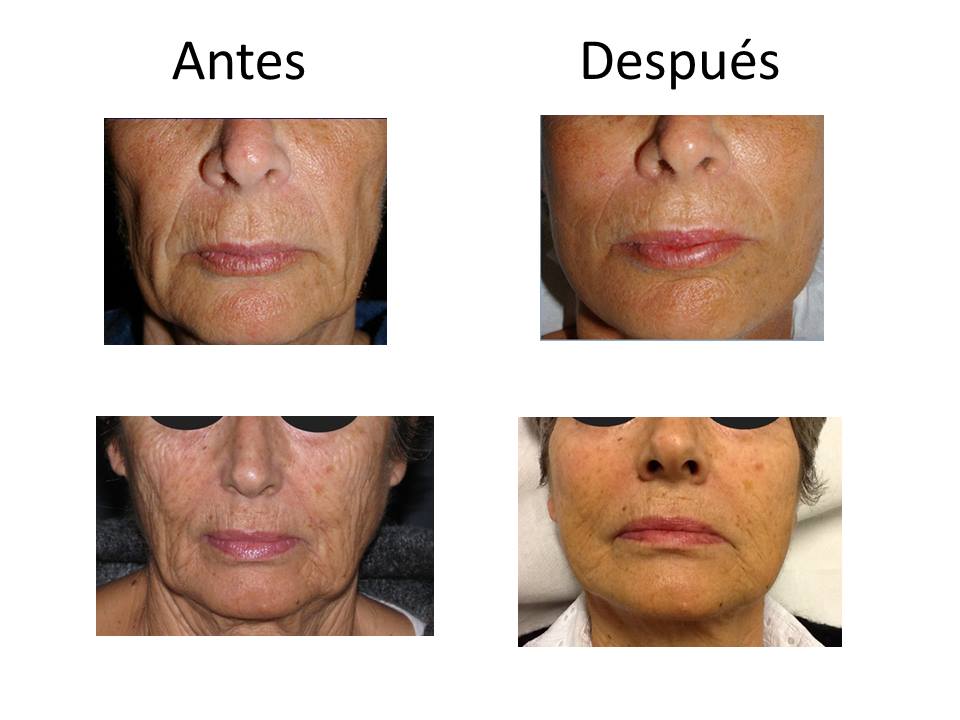 Semana de colaboraciones con los Masters de Medicina Estética